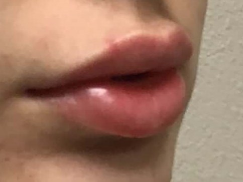 Side View After Side View After