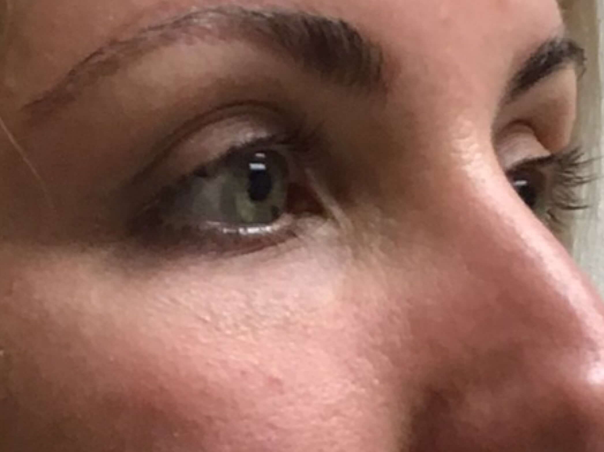 Before & After After Before & After After