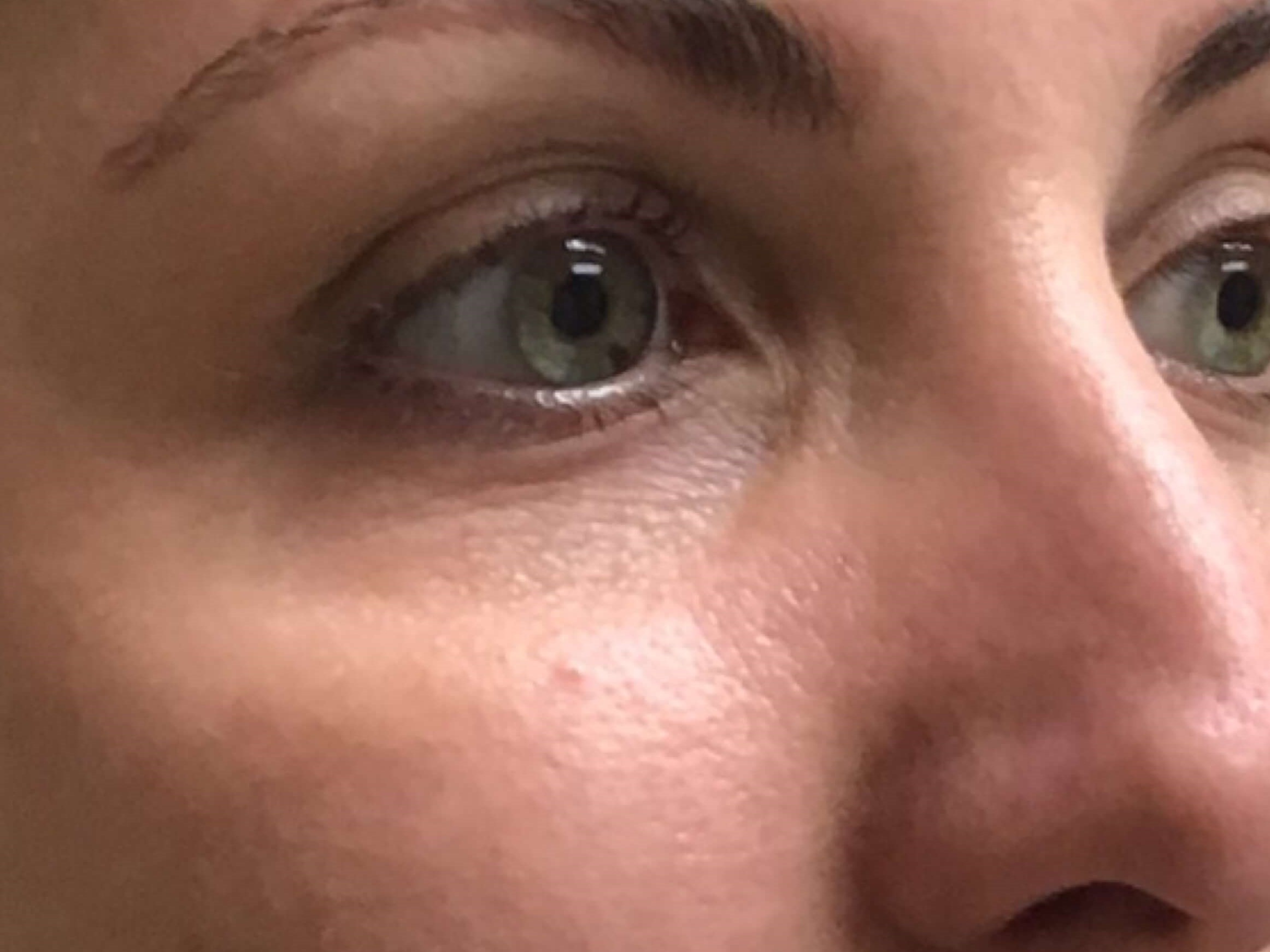 Before & After Before Before & After Before