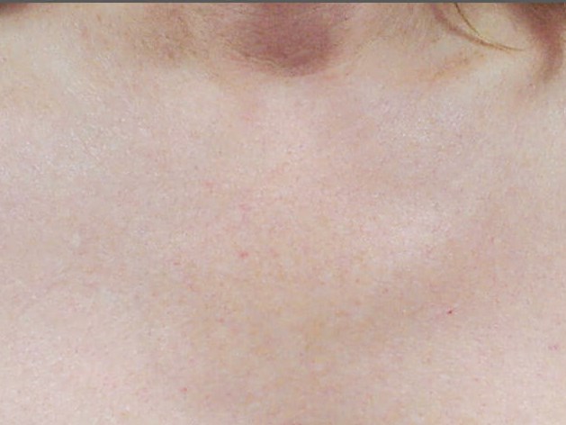 After Image