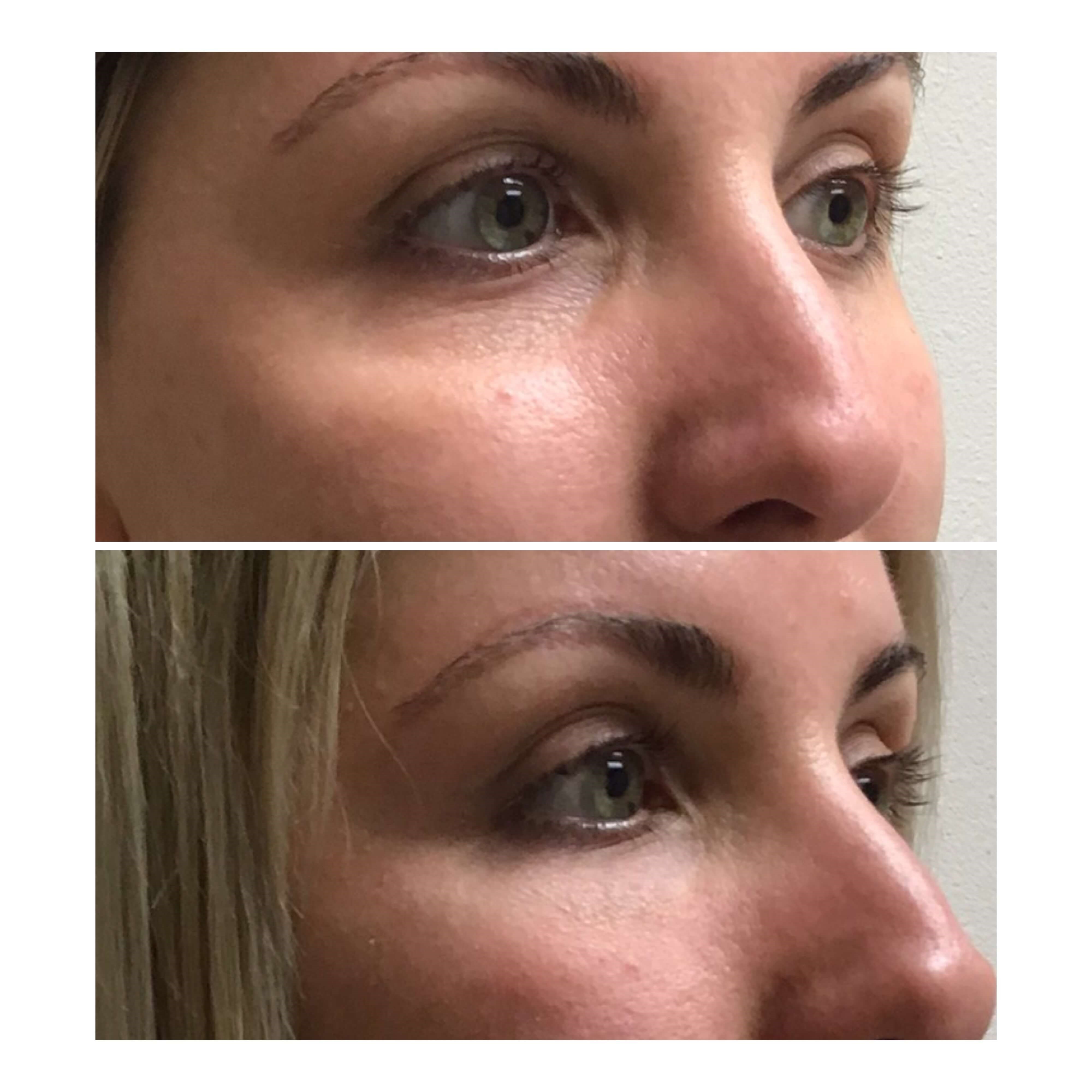 Before & After Before