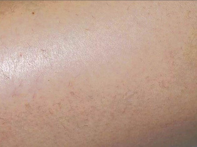 Before & After LHR After