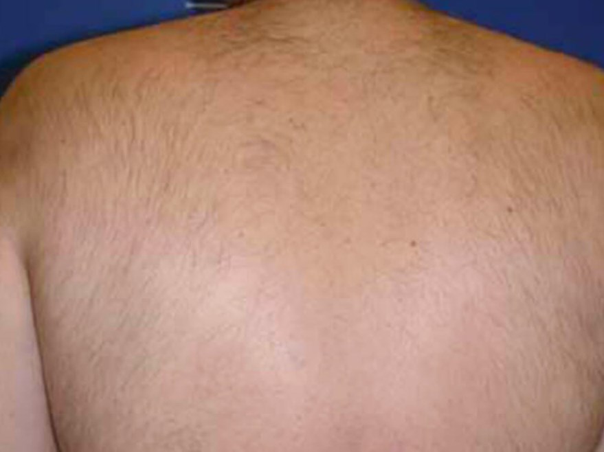 Before and After LHR After