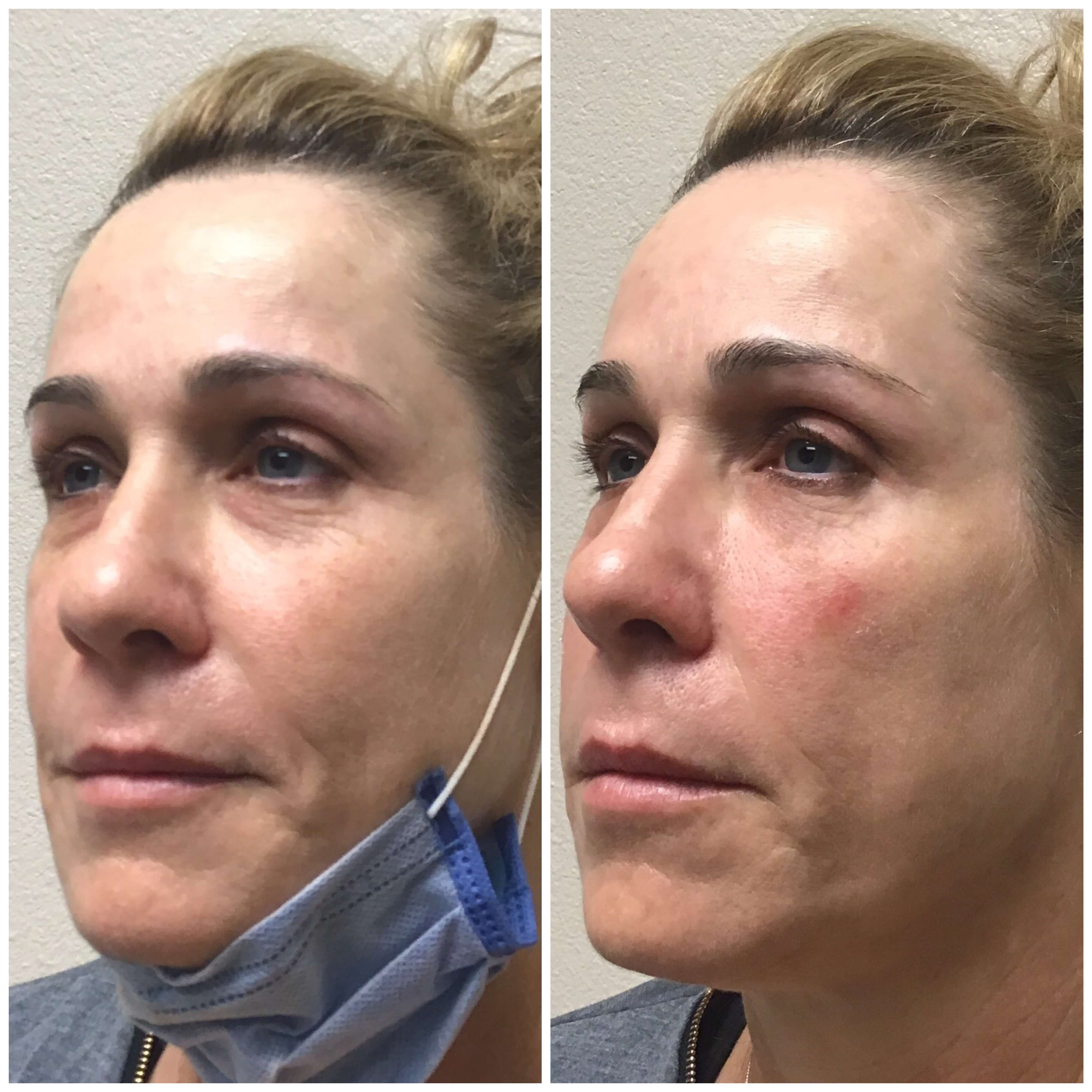 Before & After Before