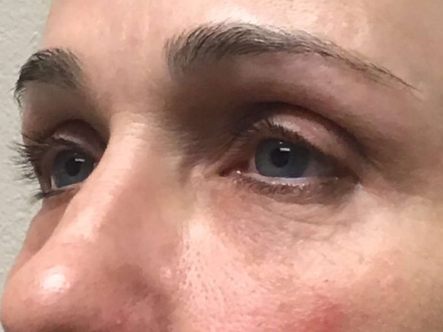 Before & After After