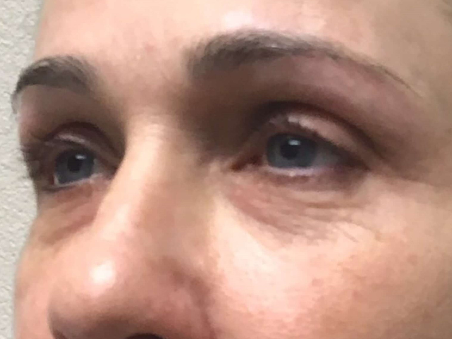 Before & After Before